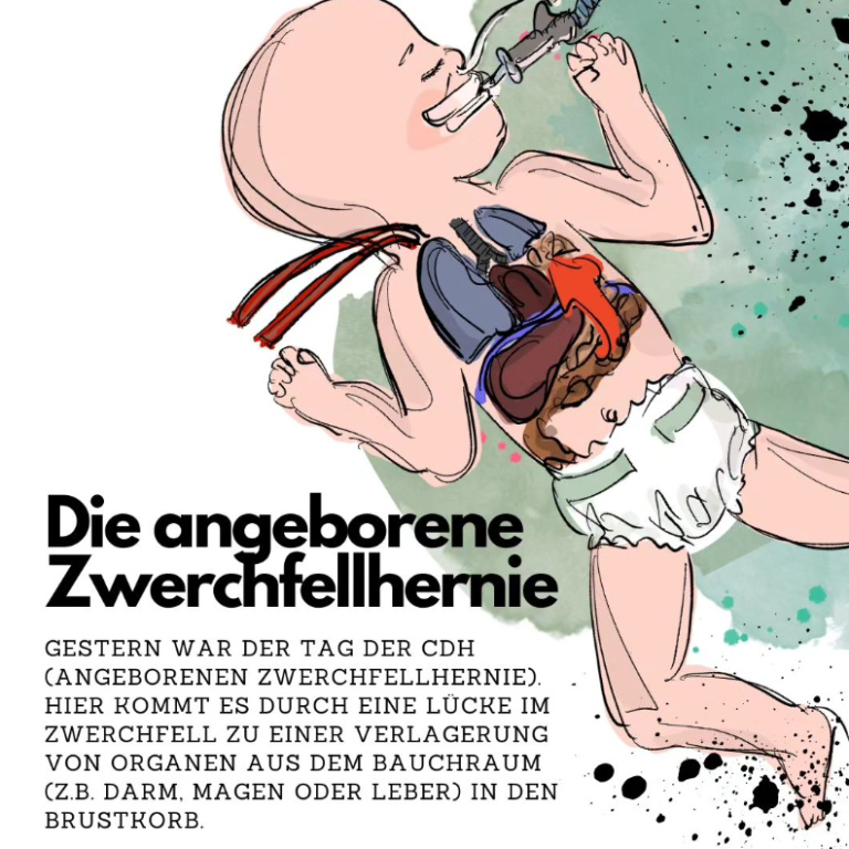 Die angeborene Zwerchfellhernie