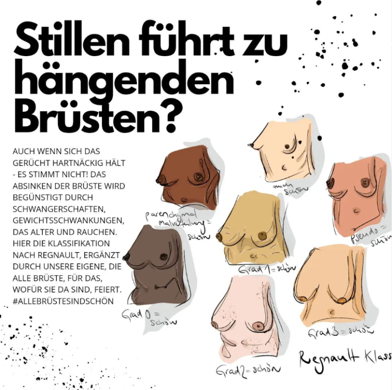 Stillen führt zu hängenden Brüsten?